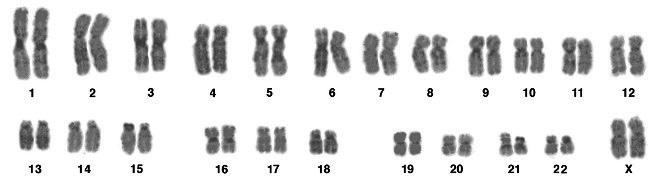 chromosomes